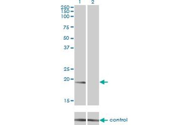 NME1 Antikörper  (AA 1-152)