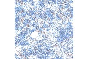 Immunohistochemistry (IHC) image for anti-Aquarius Homolog (AQR) (AA 400-700) antibody (ABIN6137057)