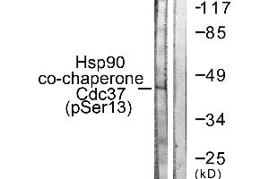 Immunohistochemistry analysis of paraffin-embedded human placenta tissue using CDC37 (Phospho-Ser13) antibody. (CDC37 antibody  (pSer13))