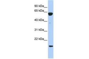 Image no. 1 for anti-Protein Tyrosine Phosphatase Type IVA, Member 3 (PTP4A3) (C-Term) antibody (ABIN6743577) (PTP4A3 antibody  (C-Term))