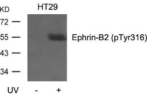 Western blot analysis of extracts from HT29 cells, untreated or treated with UV using Ephrin-B2(Phospho-Tyr316) Antibody. (Ephrin B2 antibody  (pTyr316))