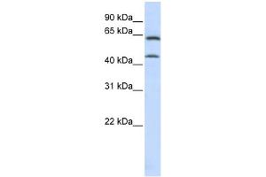 WB Suggested Anti-ChGn Antibody Titration:  0. (CSGALNACT1 antibody  (C-Term))