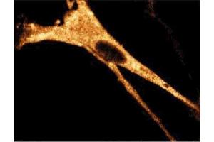 Immunofluorescence staining of WI-38 cells (Human lung fibroblasts, ATCC CCL-75). (RIPK1 antibody  (AA 385-650))