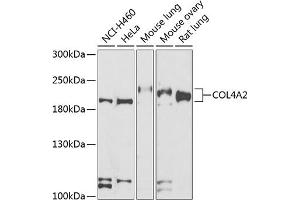 Western blot analysis of extracts of various cell lines, using COL4 antibody (ABIN6134493, ABIN6138843, ABIN6138844 and ABIN6223578) at 1:500 dilution. (COL4a2 antibody  (AA 1486-1712))