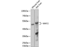 Western blot analysis of extracts of various cell lines, using WNT2 Antibody (ABIN6134457, ABIN6150238, ABIN6150240 and ABIN6217609) at 1:1000 dilution. (WNT2 antibody  (AA 1-100))