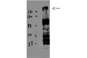 Western Blot (WB) analysis of JK using BRCA1 Polyclonal Antibody diluted at 1:1000.
