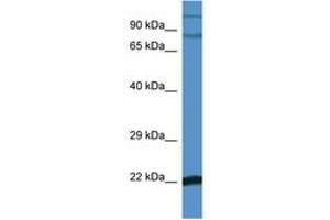 Image no. 1 for anti-Nuclear Factor of kappa Light Polypeptide Gene Enhancer in B-Cells Inhibitor, zeta (NFKBIZ) (C-Term) antibody (ABIN6746523) (NFKBIZ antibody  (C-Term))