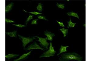 Immunofluorescence of monoclonal antibody to SEC63 on HeLa cell.