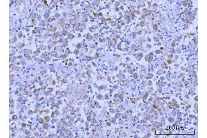 IHC analysis of Hamartin/TSC1 using anti-Hamartin/TSC1 antibody (ABIN7599499). (TSC1 antibody  (AA 1-618))