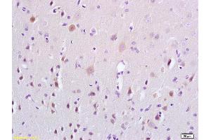 Formalin-fixed and paraffin embedded rat brain tissue labeled with Anti-ERK4 Polyclonal Antibody, Unconjugated (ABIN754288) at 1:200 followed by conjugation to the secondary antibody and DAB staining (MAPK7 antibody  (AA 401-500))
