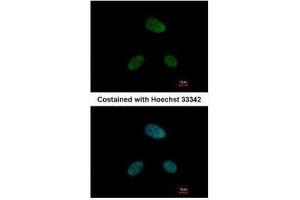 ICC/IF Image Immunofluorescence analysis of paraformaldehyde-fixed HeLa, using DRAK1, antibody at 1:500 dilution. (STK17A antibody)