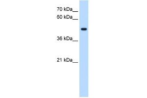STYK1 antibody used at 0. (STYK1 antibody  (C-Term))