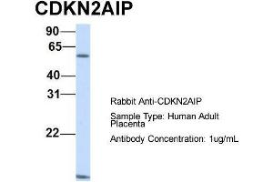 Host:  Rabbit  Target Name:  CDKN2AIP  Sample Type:  Human Adult Placenta  Antibody Dilution:  1. (CDKN2AIP antibody  (N-Term))