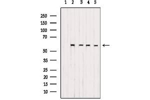 Western blot analysis of extracts from various samples, using CS061 Antibody.