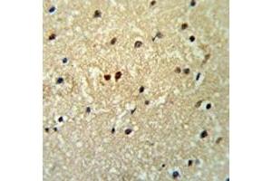 Immunohistochemistry (IHC) image for anti-Prospero Homeobox 1 (PROX1) (AA 492-520) antibody (ABIN3032345)