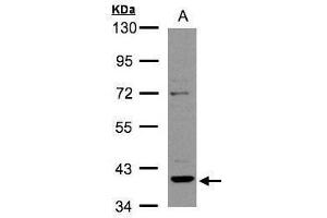WB Image Sample(30 ug whole cell lysate) A:Raji , 10% SDS PAGE antibody diluted at 1:2000 (RAD51 Homolog B antibody  (Center))