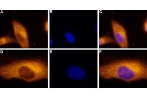 Expression of Adenosine A3 Receptor in a human melanoma cell line - Immunocytochemical staining of paraformaldehyde-fixed and permeabilized  human melanoma cells (A2058). (Adenosine A3 Receptor antibody  (3rd Intracellular Loop))