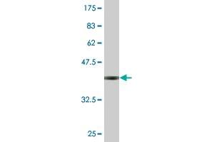 Western Blot detection against Immunogen (36. (MED22 antibody  (AA 1-100))