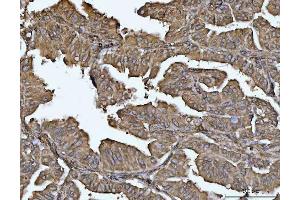 IHC analysis of VPS53 using anti-VPS53 antibody (ABIN7599731). (VPS53 antibody  (AA 11-699))