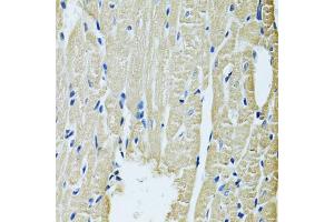 Immunohistochemistry of paraffin-embedded rat heart using SLC5A6 antibody (ABIN6292573) at dilution of 1:100 (40x lens). (SLC5A6 antibody)