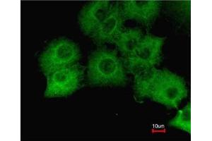 Immunofluorescence analysis of paraformaldehyde-fixed A549, using GAPDH antibody at 1:200 dilution. (GAPDH antibody  (AA 9-323))
