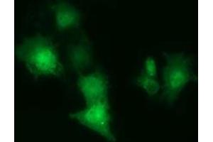 Anti-CBWD1 mouse monoclonal antibody (ABIN2452882) immunofluorescent staining of COS7 cells transiently transfected by pCMV6-ENTRY CBWD1 (RC222790). (CBWD1 antibody)