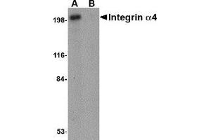 Western blot analysis of Integrin alpha 4 in Jurkat cell lysate with AP30434PU-N Integrin alpha 4 antibody at 1 μg/ml in (A) the absence and (B) the presence of blocking peptide. (ITGA4 antibody  (C-Term))