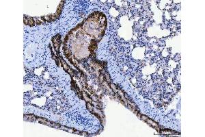 IHC analysis of CD166/ALCAM using anti-CD166/ALCAM antibody (ABIN5518801).
