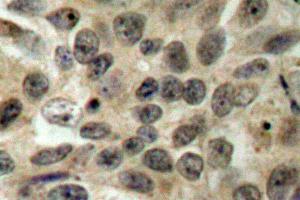 Image no. 1 for anti-Cell Division Cycle 25 Homolog C (S. Pombe) (CDC25C) antibody (ABIN265342) (CDC25C antibody)