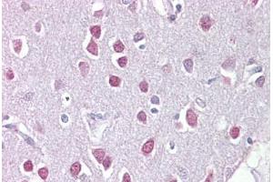 Anti-ETV1 / ER81 antibody IHC staining of human brain, cerebellum. (ETV1 antibody  (C-Term))