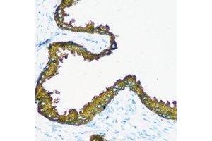 Immunohistochemical analysis of RRM1 staining in human prostate formalin fixed paraffin embedded tissue section. (RRM1 antibody)