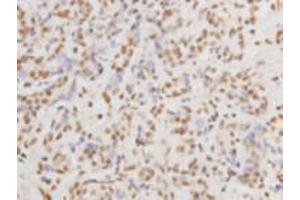 Immunohistochemistry (Paraffin-embedded Sections) (IHC (p)) image for anti-Protein Kinase, DNA-Activated, Catalytic Polypeptide (PRKDC) (Catalytic Subunit) antibody (ABIN1854884) (PRKDC antibody  (Catalytic Subunit))