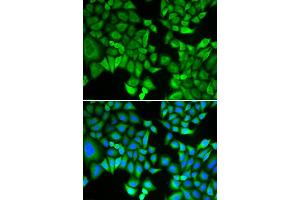 Immunofluorescence analysis of A549 cell using KPNA2 antibody.