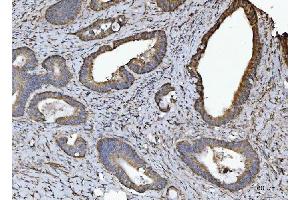 IHC analysis of NDUFV2 using anti-NDUFV2 antibody (ABIN7599154). (NDUFV2 antibody  (AA 1-249))