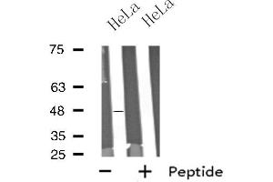 Western blot analysis of extracts from HeLa cells using SCTR antibody. (SCTR antibody  (Internal Region))