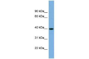 SAE1 antibody used at 1 ug/ml to detect target protein. (SAE1 antibody  (N-Term))