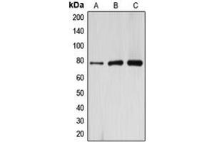 Western blot analysis of ARHGAP22 expression in HeLa (A), mouse kidney (B), rat kidney (C) whole cell lysates. (ARHGAP22 antibody  (C-Term))