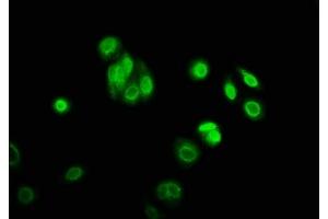 Immunofluorescence staining of HepG2 cells with ABIN7169445 at 1:166, counter-stained with DAPI. (SHF antibody  (AA 1-159))