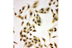 Immunohistochemistry (IHC) image for anti-Neuregulin 1 (NRG1) (AA 617-636), (C-Term) antibody (ABIN3044035)