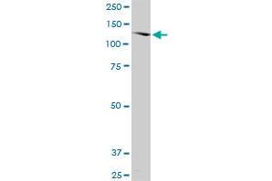 SORCS2 monoclonal antibody (M03), clone 1D7. (SORCS2 antibody  (AA 802-900))