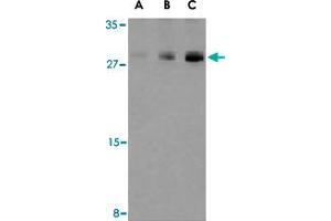 Western blot analysis of CASP7 in human skeletal muscle tissue lysate with CASP7 polyclonal antibody  at (A) 0. (Caspase 7 antibody  (C-Term))