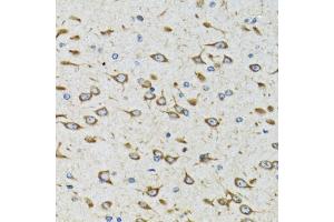 Immunohistochemistry of paraffin-embedded rat brain using AKTIP antibody (ABIN6131091, ABIN6136746, ABIN6136748 and ABIN6221837) at dilution of 1:100 (40x lens). (AKTIP antibody  (AA 1-292))