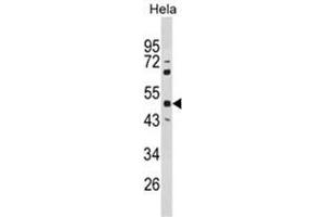 Western blot analysis of PAX6 Antibody (Center) in Hela cell line lysates (35ug/lane). (PAX6 antibody  (Middle Region))