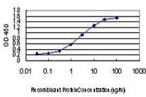 Detection limit for recombinant GST tagged CDKL1 is approximately 0. (CDKL1 antibody  (AA 259-358))