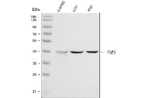 Western blot analysis of Spermine Synthase/SMS using anti-Spermine Synthase/SMS antibody (ABIN7599638).