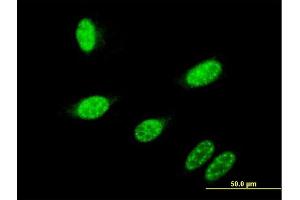 Immunofluorescence of monoclonal antibody to GBX2 on HeLa cell.
