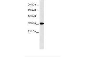 Image no. 1 for anti-Zinc Finger and BTB Domain Containing 32 (ZBTB32) (N-Term) antibody (ABIN6735911) (ZBTB32 antibody  (N-Term))