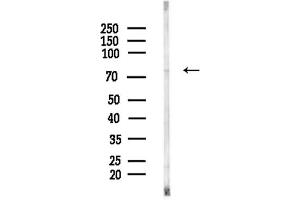 anti-Phosphoinositide 3 Kinase, p85 beta (PI3K p85b) (C-Term) antibody