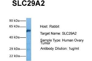 SLC29A2 antibody  (C-Term)