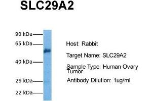 Host: Rabbit Target Name: SLC29A2 Sample Tissue: Human Ovary Tumor Antibody Dilution: 1. (SLC29A2 antibody  (C-Term))